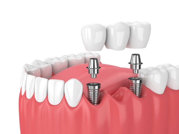 Services Image Services Image
