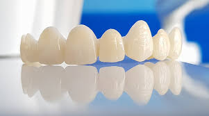 Dental Crown Onlays Dental Crown Onlays