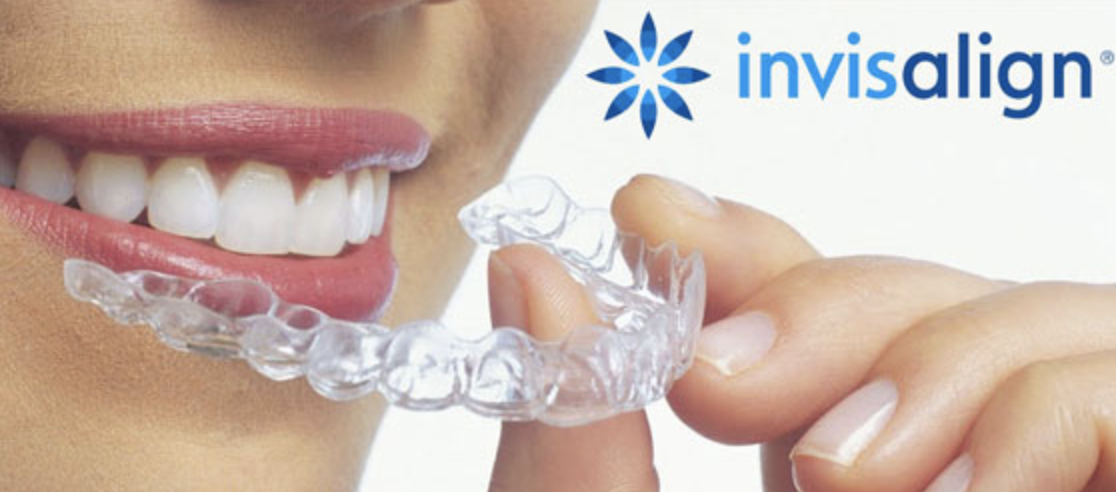 Invisalign Image Invisalign Image